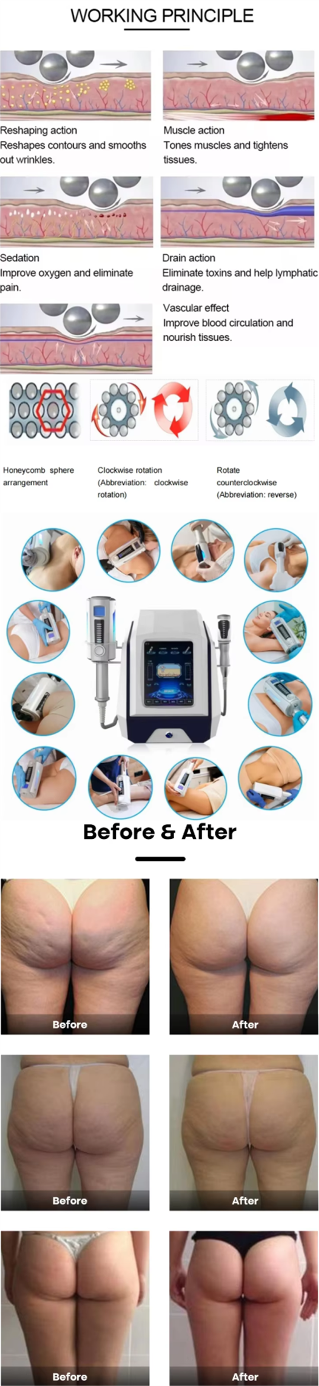 Body Shaping Contouring Inner Roller Machine For Cellulite Reduction