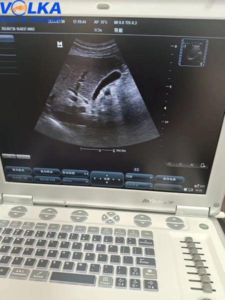 Sistema portátil de ultra-som original Mindray M7
