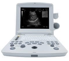 Professional Sonography Machine 2-12 Mhz Frequency DC12.8V 3.0A Adapter Output for Accurate Diagnosis
