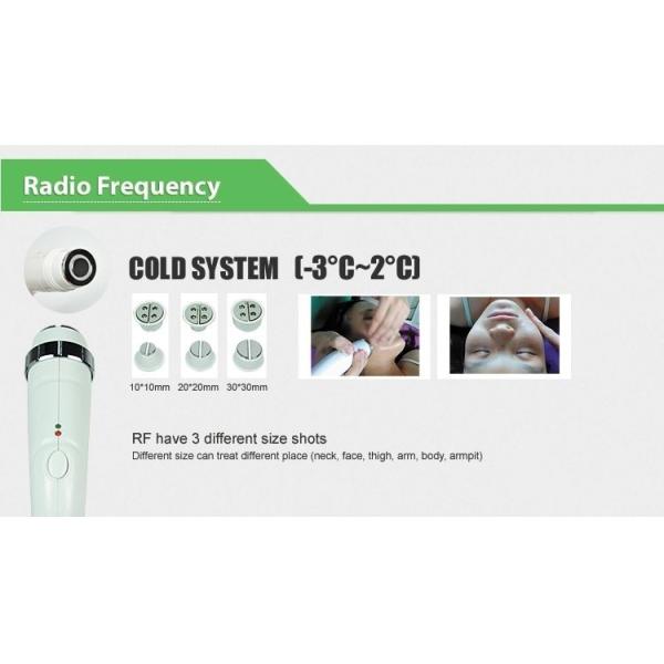 1064nm/532nm OPT IPL RF ND YAG Laser Hair Removal Machine 3 Handles