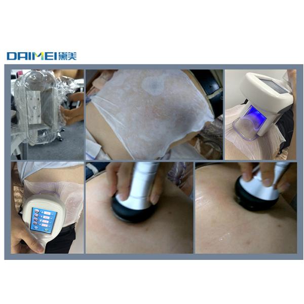 40k Ultrasonic Cavitation Machine Radio Frequency Cryolipolysis Fat Freezing Machine