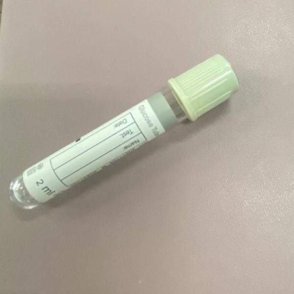 Медицинский осмотр трубки крови глюкозы фторида GlSodium ЭТИЛЕНДИАМИНТЕТРАЦЕТАТА