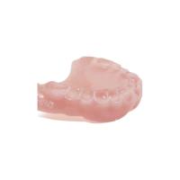 Corona dental de pulido gruesa/fina 3D de PFM que imprime las coronas temporales