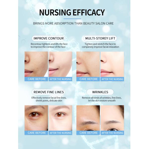 2 in 1  HIFU 7d hifu face lift machine high intensity focused ultrasound hifu face lift machine