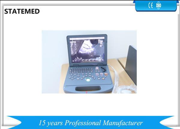 High Definition Portable Doppler Machine / 3d Ultrasound Machine With Trolley Cart