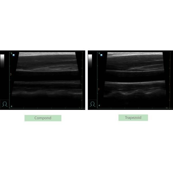 High Resolution Laptop B/W Ultrasound MSK Ultrasound Scanner Laptop Ultrasound Machine