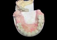 Coroa de zircônio de lava de aparência natural com durabilidade inigualável Excelente biocompatibilidade