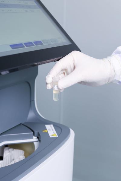 IVD closed system chemiluminescence Immunodiagnosis  test kit HBsAg HBsAb HBeAg HBeAb HBcAb Anti-HCV Anti-HIV Anti-TP