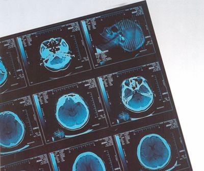 Thermal seco médico do filme de X Ray de Digitas para o CR do hospital/Dr.