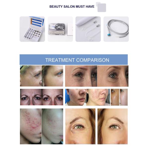 Многофункциональное оборудование для очистки лица с аквапилированием, кислородным струем Hydra Hydro Dermabrasion с анализатором кожи