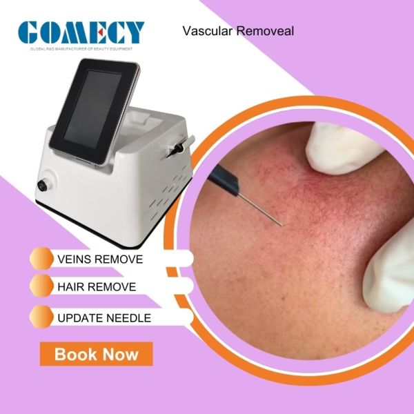 Needles RF 13.56MHz Radio Frequency Electrolysis for Safe Permanent Hair Removal and Vascular Therapy