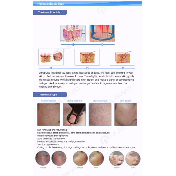 Professional fractional CO2 laser skin rejuvenation vaginal tightening machine