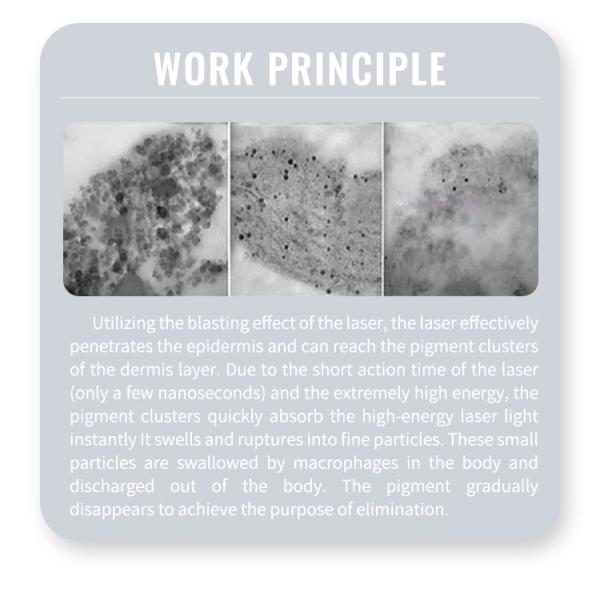 Portable 1064 Nd Yag Laser Hair Removal Machine 7 Inch Screen For Skin Whitening