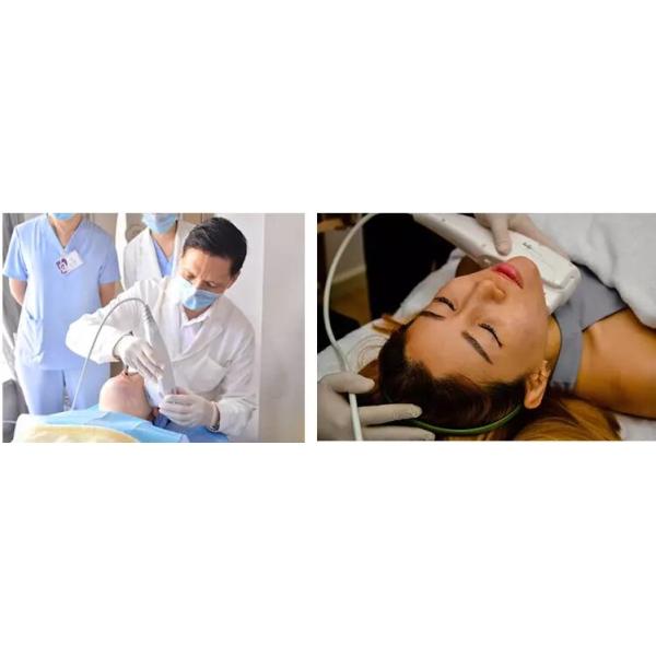 машина хифу 3Д 808нм ултерапы извлекает морщинки улучшая цвет лица кожи