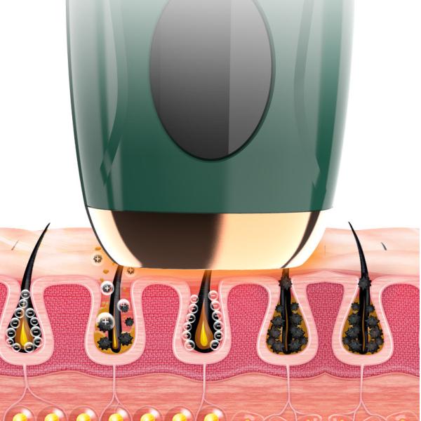 IPL 990, 000 Flashes Handheld Laser Hair Remover Permanent Painless