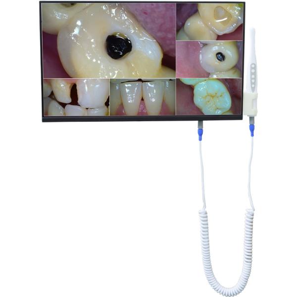 Монитор 21,5 настольного компьютера держателя стены зубоврачебный медленно двигает белая камера монитора экранного дисплея СИД LCD Intra устная