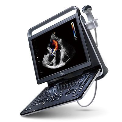 128 Element Wifi Ultrasound Chison EBit 60 For Cardiovascular
