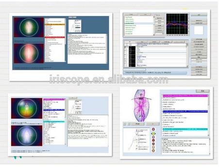 Bioresonance Therapy Health Analyzer Machine , Quantum Bio feedback