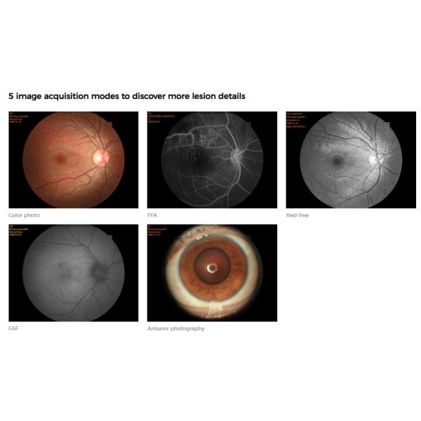 Ранг многофункционального оборудования фотографии камеры Fundus цифров профессиональная