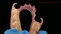 Dental TCS Valplast Flexible Partial Dentures Dental Lab 3D Print Model High Esthetics