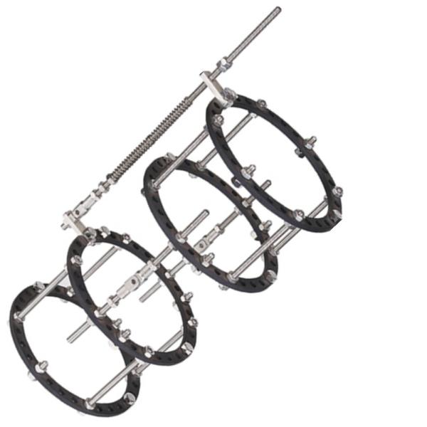 Elbow Joint External Fixator Tibial Femur Annular Ring Fixator