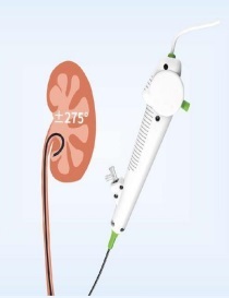 Disposable electronic pyeloscopy with low cost and convenient operation  smart disposable electronic pyeloscopy
