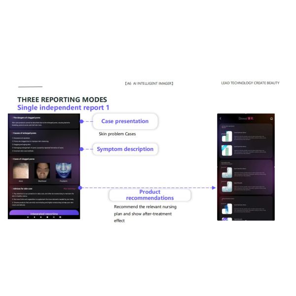 Beauty Spa Skin Care CentersDigital Partner For Skin Analysis With Al Intelligent System Acne Pigment Pores Test and Analysis