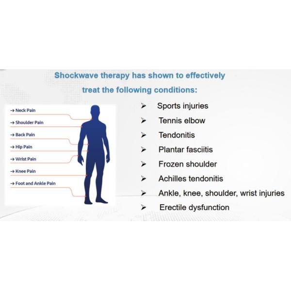 1MHz Shockwave Therapy Machine For Achilles Tendonitis Cellulite Reduction ED Treatment
