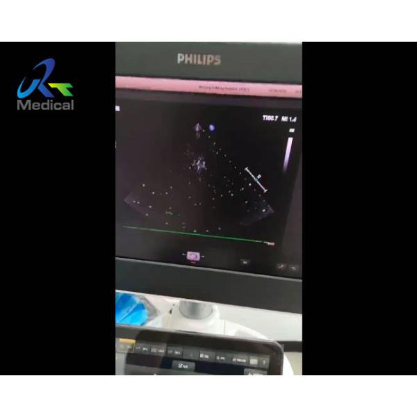 EPIQ 5 Ultrasound Machine Repair Abnormal Image Snowflake Interference Replace ACQ