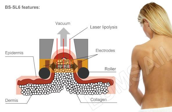 Cryolipolysis Fat Freeze Slimming Machine Body Slimmer Contouring System For Fat Resolving