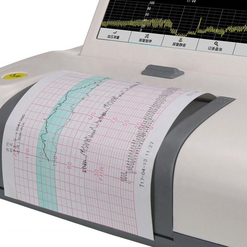 Durable Necessary Hospital Pregnant Women NST Cardiotocography Machine Ctg Machine Maternal Fetal Monitor For Baby Heartbeat