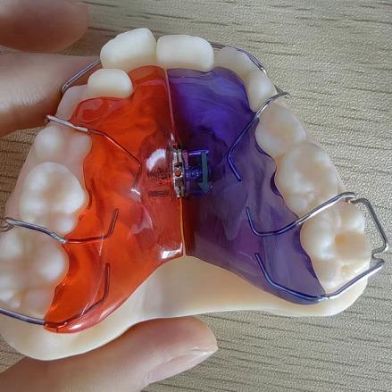 Smooth Surface Plastic Implantation Scenarios for Customized Solutions