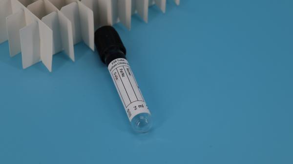 Tubo de centrífuga de amostra de sangue de vazio para laboratório médico