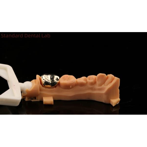 High Nobel Yellow Gold Crown Tooth Professional Ni Be Free ISO And FDA Approved China Dental Lab