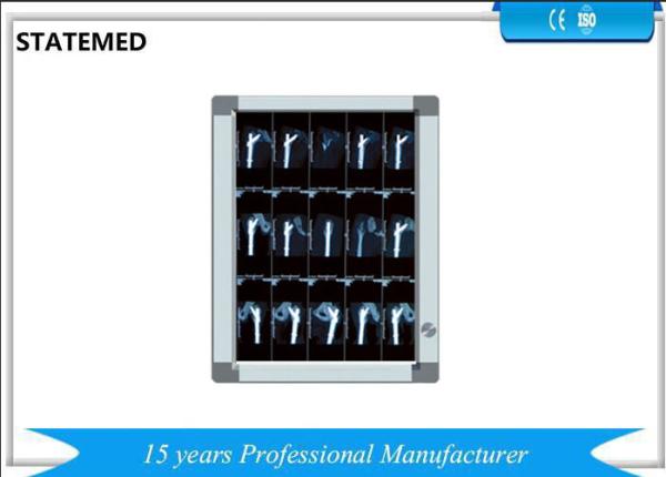 Super Thin LED X Ray Film Viewer Medical Led X Ray Negatoscope Film Viewer