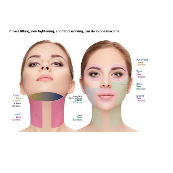 Latest Hifu 7D Focused Ultrasound 7D Hifu Body And Face Slimming Machine 7D Hifu For Winkle Removal