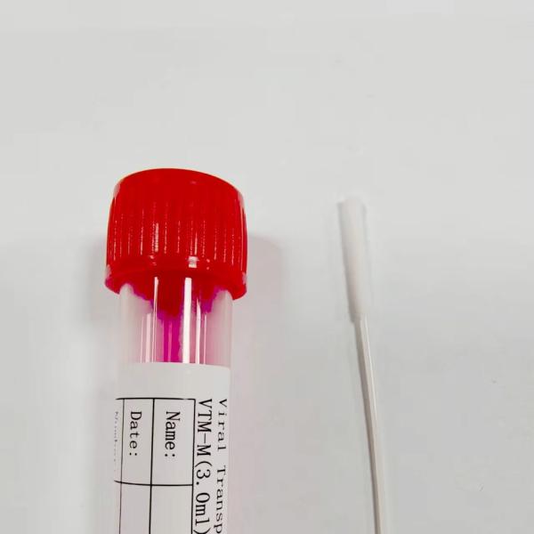 150mm Disposable Medical Consumables Universal Transport Medium Components Class I Plastic