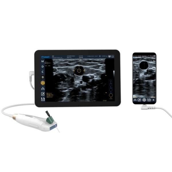 64 Channel 20mm Depth Handheld Ultrasound Scanner For Peripheral Vascular Assessment and Ultrasound-Guided Vascular Access