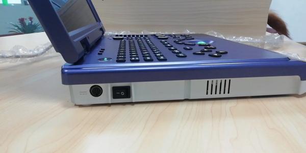 CE Portable Ultrasonic Diagnostic System 4d Color Doppler Ultrasound 300mm