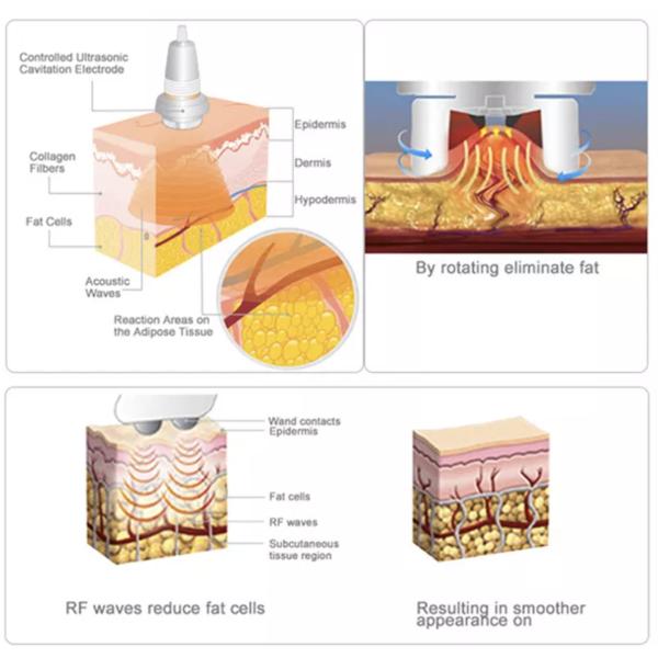 Bio 5 In 1 Skin Tightening Machine 40K Ultrasound Vacuum RF Cavitation Machine