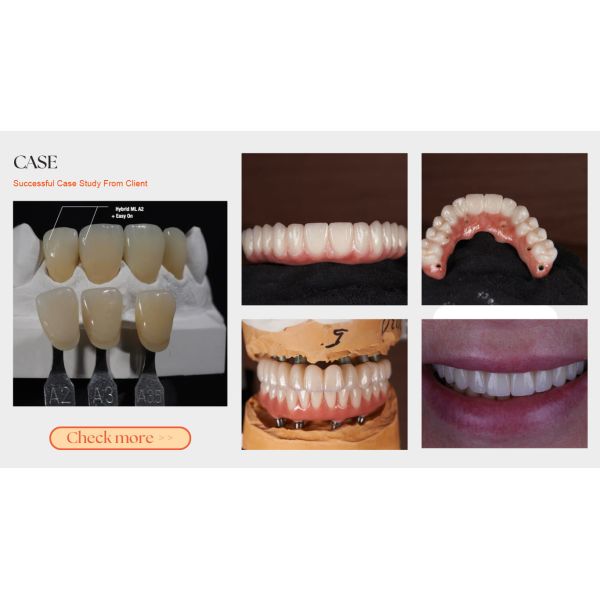 HT-PLUS White Zirconia Block High Translucent Classic 10-25mm