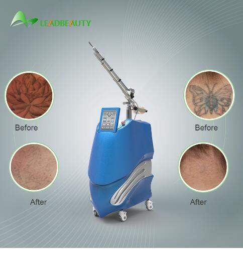 Blue one PICO SECOND Nd:YAG laser for tattoo removal/ Ota removal machine