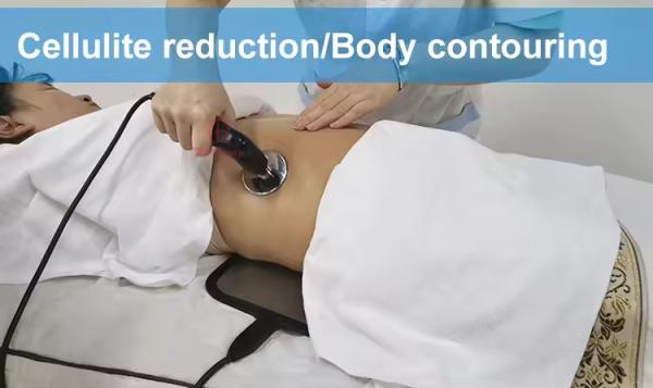 Pain Relief Sport Injuries RET CET Diatermia Tecar Therapy Machine