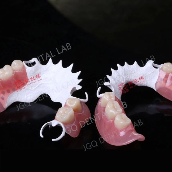 3D Printing Peek Frame Removable Dentures Acrylic Teeth China Dental Lab
