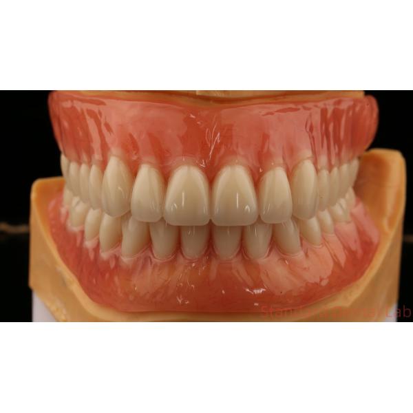 Heat Cured Ivoclar Full Acrylic Denture Dental Lab High Accuracy High Esthetic Advantage