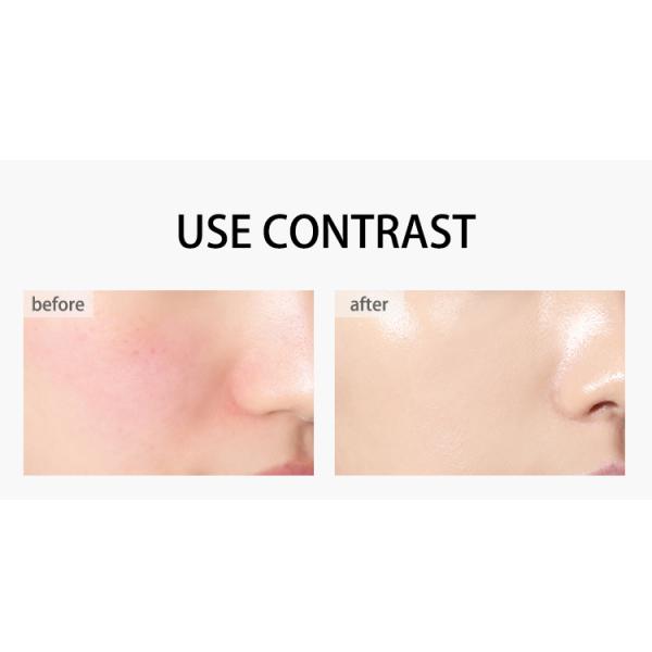 Hyaluronic кисловочный разводя водой лицевой тонер распыляет поры сокращения