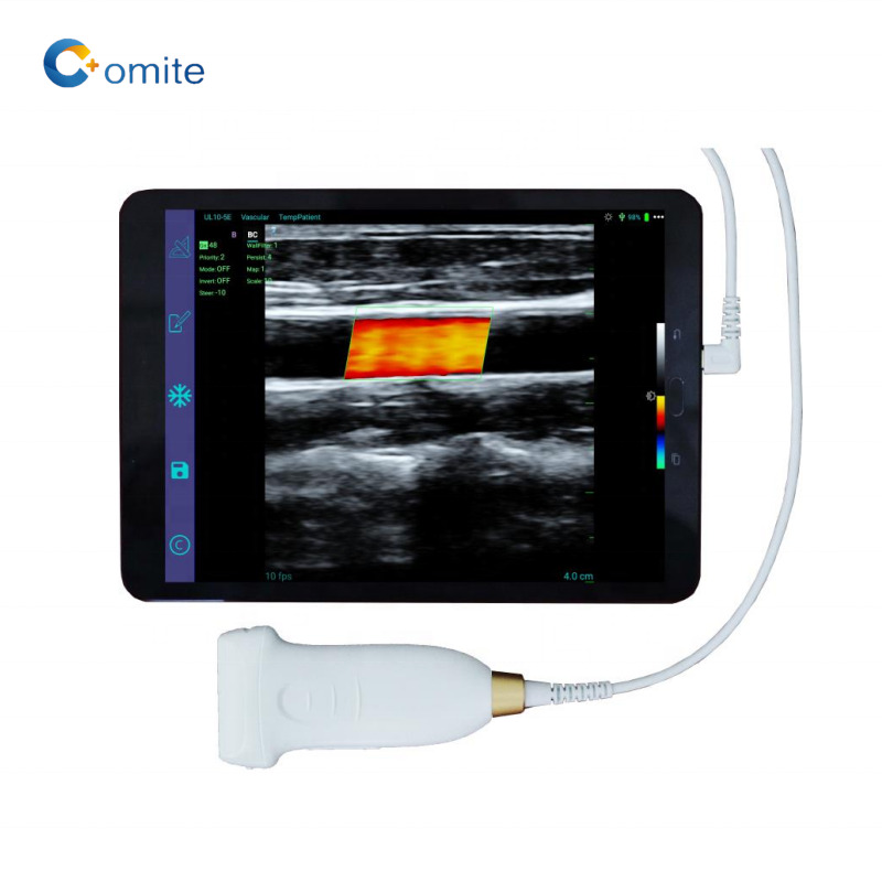 GYN Ultrasound Probe 3 in 1 usb wifi convex ultrasound wireless probes for android