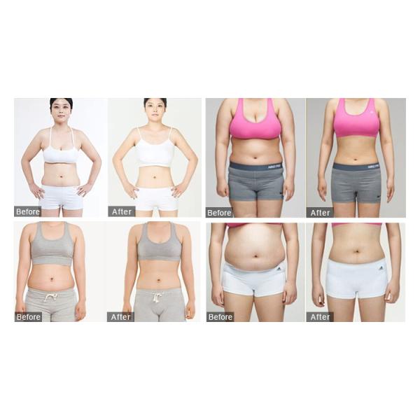 2 In 1 Multifunctional 3D HIFU Machine Facial Lifting Weight Loss Beauty Machine