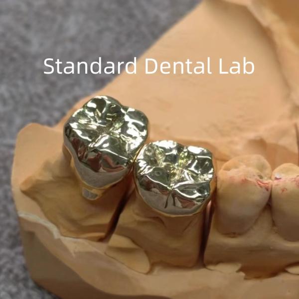 High Nobel Yellow Dental Gold Crowns Professional Ni Be Free ISO Approved