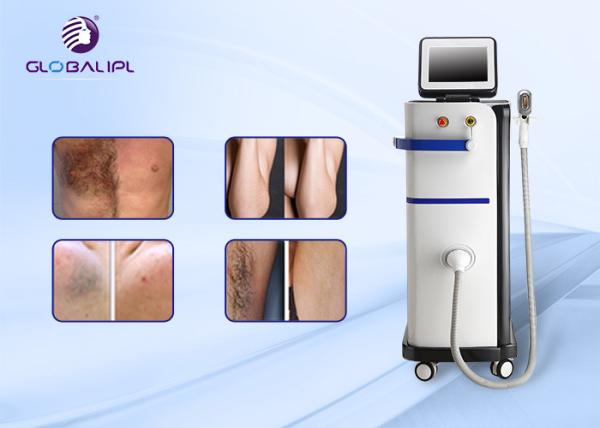 Germany 808nm Diode Laser 13x13mm Microchannel Hiar Removal Machine